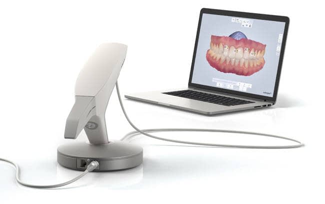 Escáner intraoral Trios 3Shape conectado a un ordenador